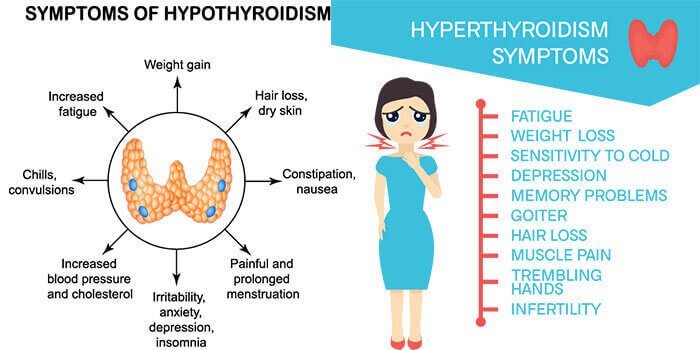 Thyroid Consultant near me