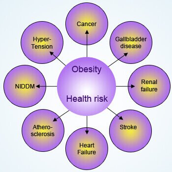 Doctor for Obesity Treatment