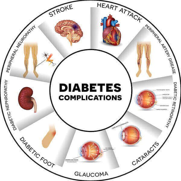 Sugar Specialist Doctor in Hyderabad