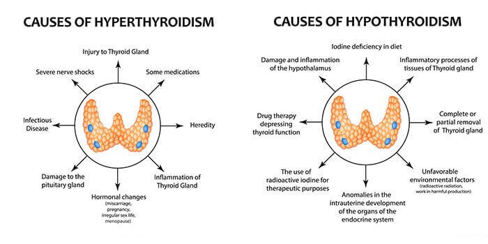 Best Doctor for Thyroid Treatment in Hyderabad